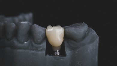 Photo of Nitrous Oxide in Modern Dental Implant Procedures with James Kleiber Dentist