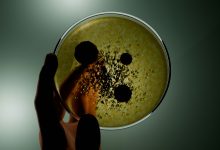 Photo of E. coli and mould found on item millions of Brits use daily
