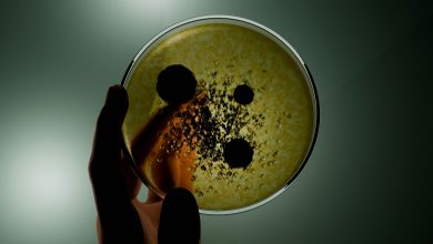 Photo of E. coli and mould found on item millions of Brits use daily