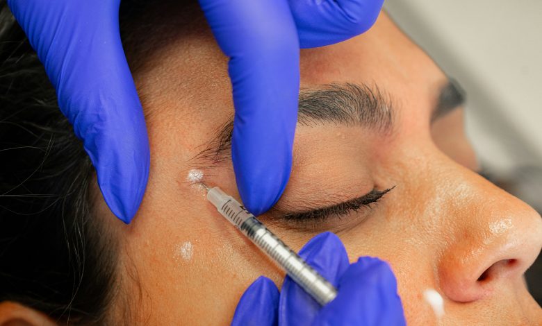 Cosmetic Procedures in Ireland A Growing Trend