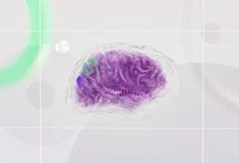 Photo of APOE4 Nell2 brain hyperactivity may signal Alzheimer’s decades early