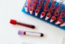 Photo of C3 protein calorie restriction link opens new path to anti-ageing drugs