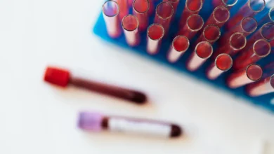 Photo of C3 protein calorie restriction link opens new path to anti-ageing drugs