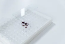Photo of Alcohol-related liver disease RNA splicing errors may block recovery even after abstinence