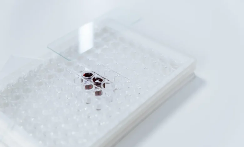 alcohol-related liver disease RNA splicing