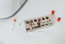 Photo of Blood Bicarbonate CO2 Rise Traced Across 20 Years of US Health Data