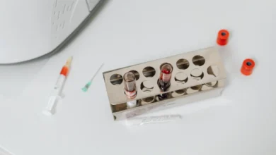 Photo of Blood Bicarbonate CO2 Rise Traced Across 20 Years of US Health Data