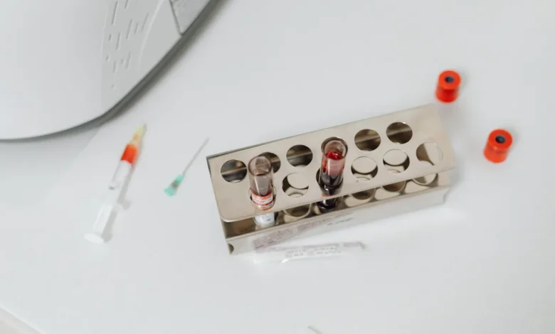 blood bicarbonate CO2 rise
