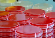 Photo of Sucralose and Stevia Gut Microbiome Changes Detected Across Two Mouse Generations