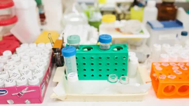 Photo of Alzheimer’s 3D genome organisation disrupted across multiple brain cell types, study in Science finds