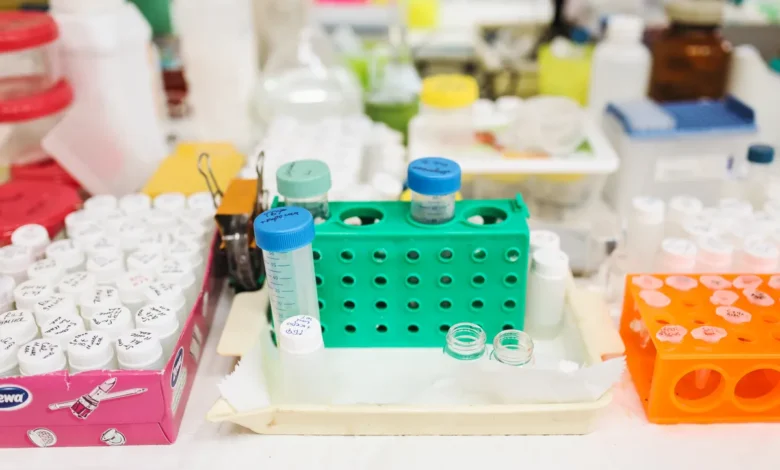 Photo of Alzheimer’s 3D genome organisation disrupted across multiple brain cell types, study in Science finds