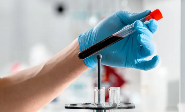 BioTAK score Takotsubo diagnosis