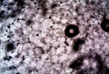 Photo of RSO-021 mesothelioma trial results show 67% disease control in phase one study