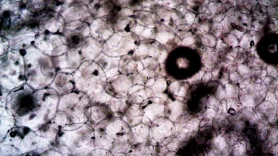 Photo of RSO-021 mesothelioma trial results show 67% disease control in phase one study
