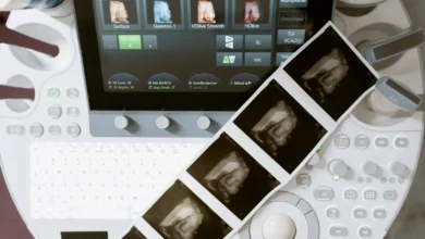 Photo of Coronary calcium scan benefit may be limited to borderline-risk patients, 10-year study finds