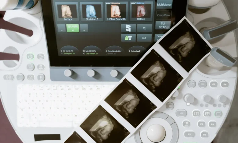 coronary calcium scan benefit