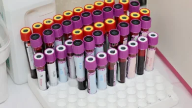 Photo of Early-onset cancer biological aging link found across 160,000 adults in new study