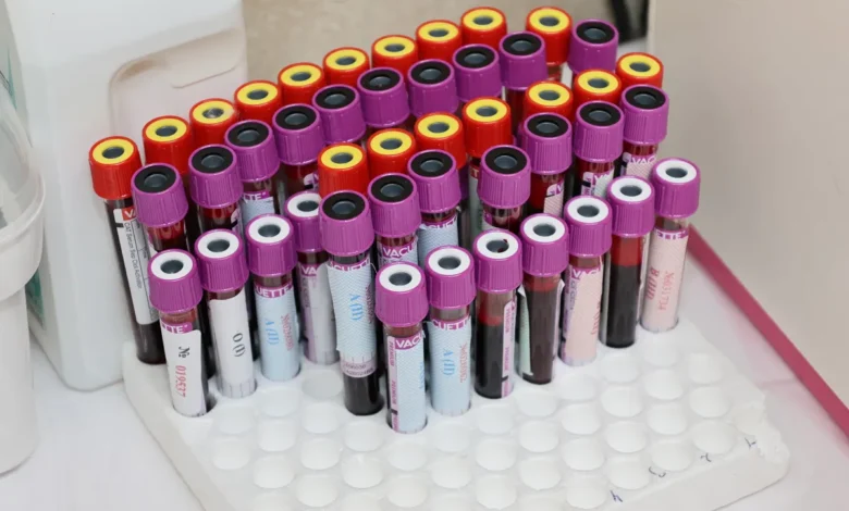 early-onset cancer biological aging