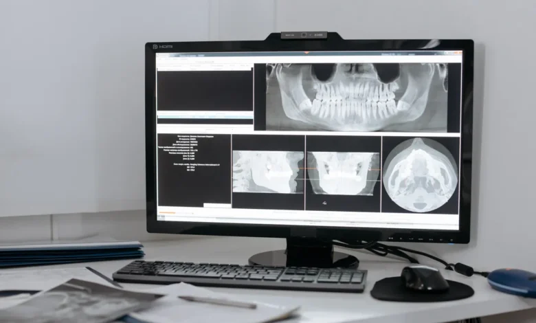 Photo of Mammogram overdiagnosis rate may be far lower than trials suggested