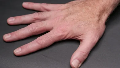 Photo of GLP-1 nail detachment study finds fourfold rise in users at EADV 2026