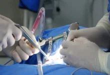 Photo of Lacosamide osteoarthritis cartilage repair claim rests on preclinical data