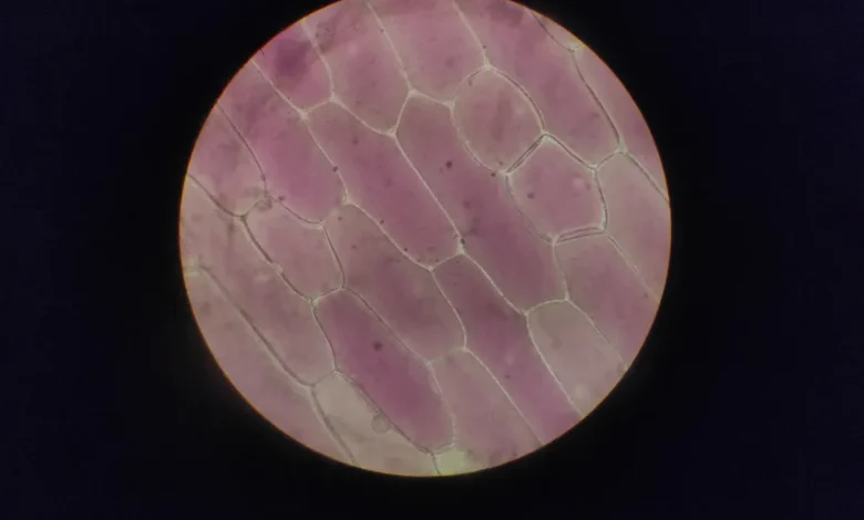 Photo of Leucine mitochondrial energy production boosted via protein quality control, Cologne study finds